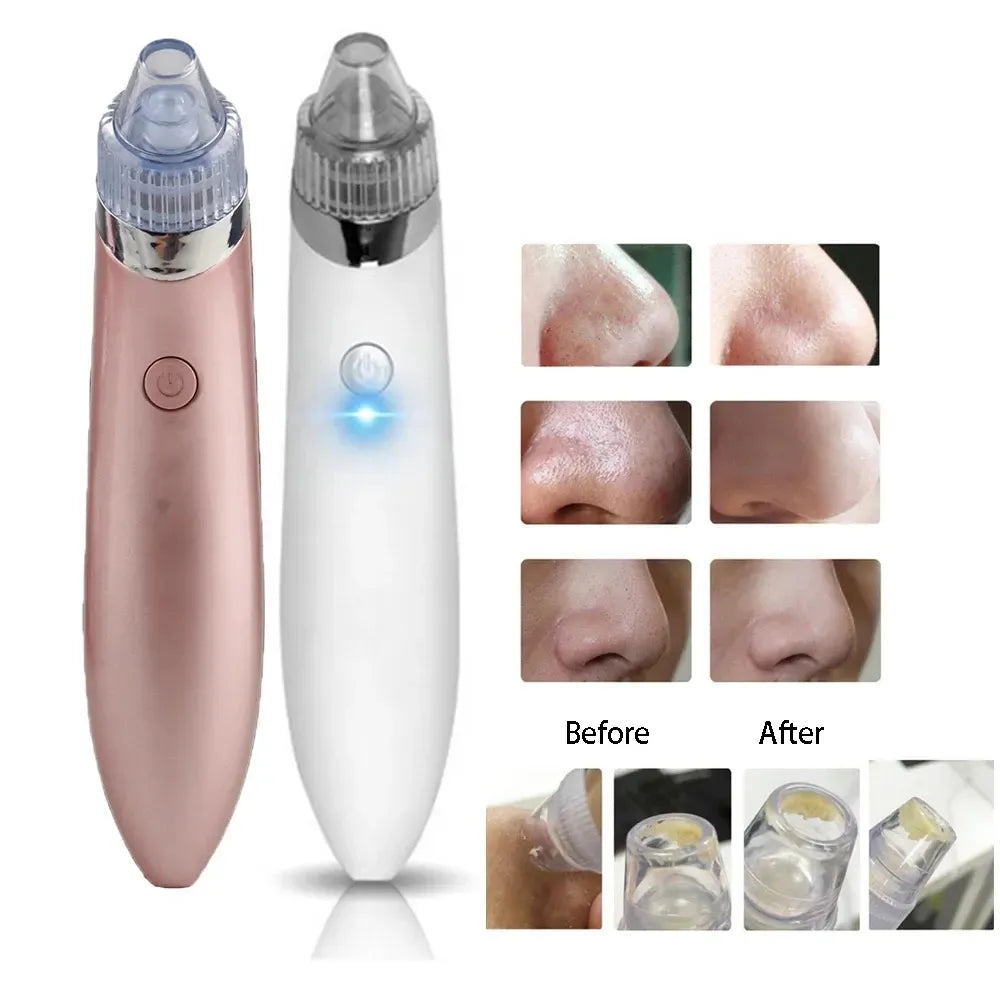 Electric Blackhead Acne Oil Remover Vacuum Suction Face Pore Cleaner Facial Beauty Equipment,Blackhead Removal Machine